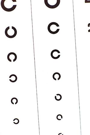 宝塚で叶える！アレルギー性鼻炎対策の最新2025年完全ガイド